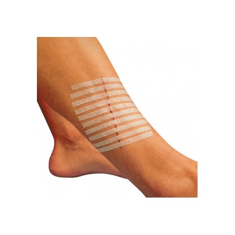 Suture steri-strip 3x75mm par 5